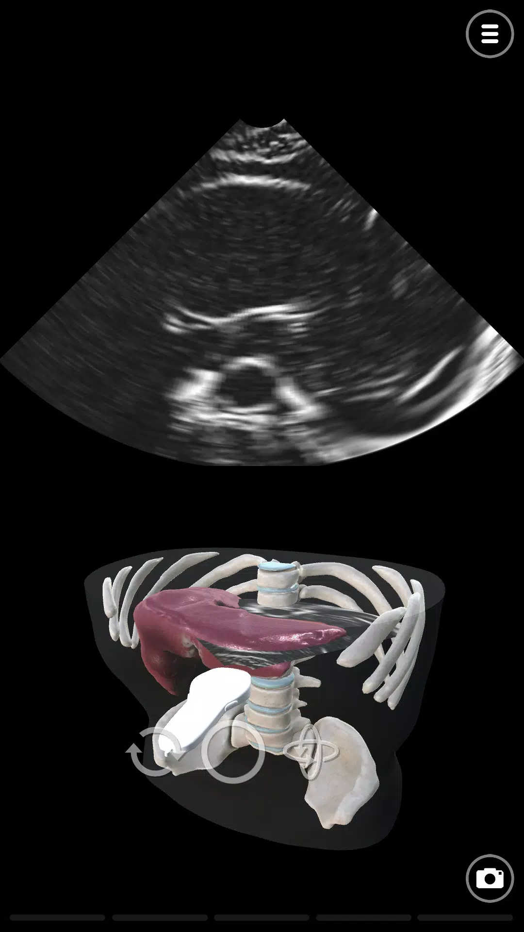 Deepscope Ultrasound Simulator 스크린샷 1