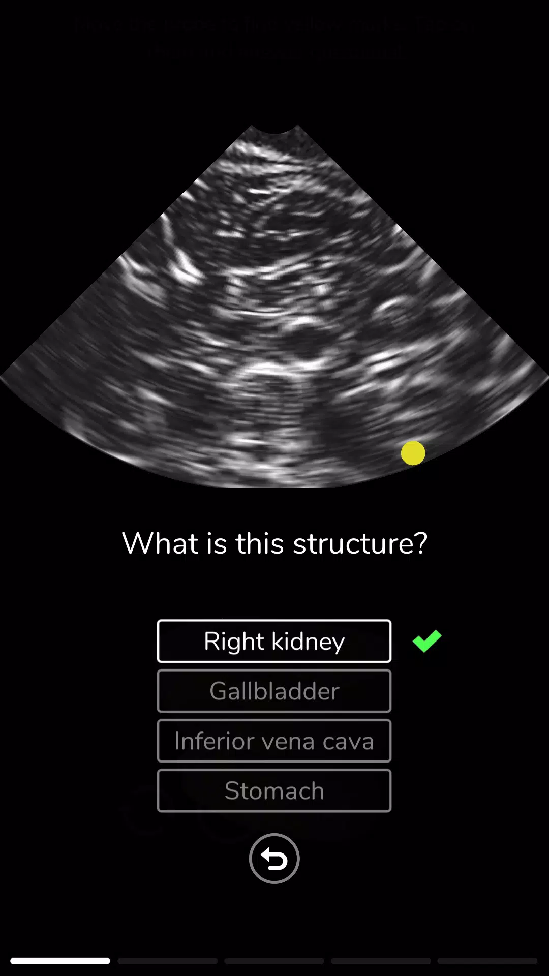 Deepscope Ultrasound Simulator 스크린샷 3